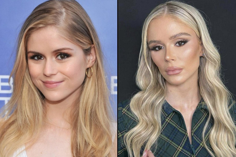 Erin Moriarty Before and After Plastic Surgery