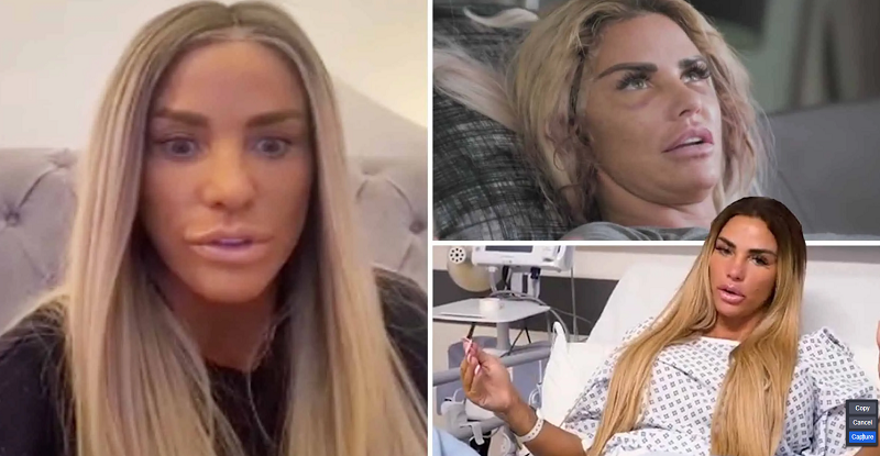 Katie Price Plastic Surgery: Get The Transformations and Impact!